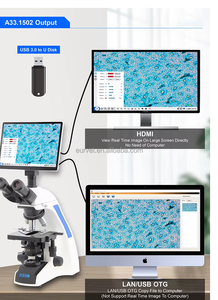 Microscope biologique trinoculaire <span class=keywords><strong>EUR</strong></span> VET avec écran 12 pouces, imagerie HD 5MP 60fps, fonctionnement sans fil, enregistrement et mesure pour laboratoire vétérinaire - Product Image 4