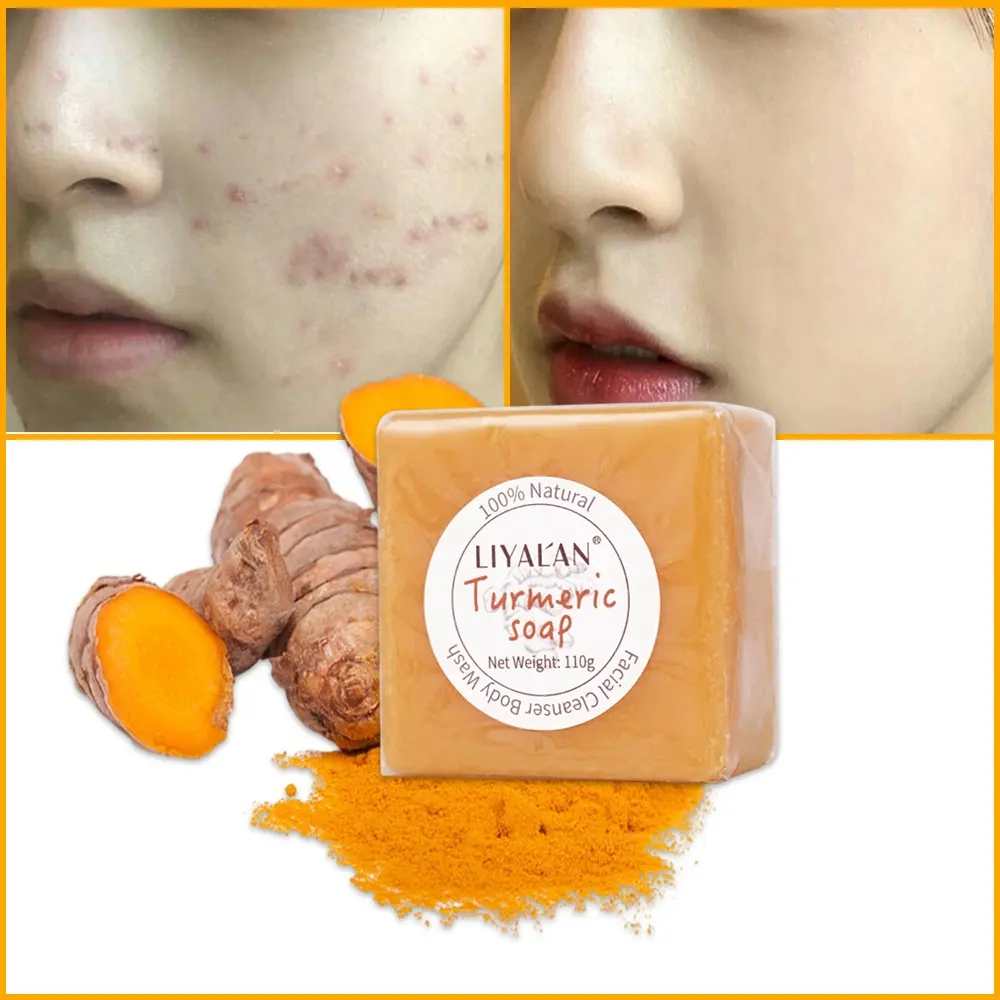 Private Label Natural Skin Beauty Nourishing Tumeric Soap Acne Whitening Organic Handmade Ginger Turmeric Soap