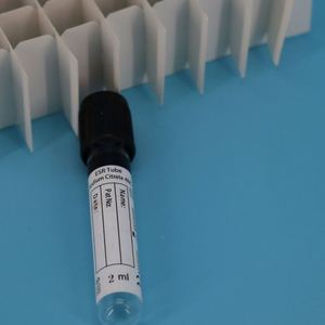 Tabung Pengumpul Vakum Sekali Pakai 10ml Tutup Ungu Kaca K2/K3 Aditif EDTA untuk Gigi Multiguna - Product Image 4