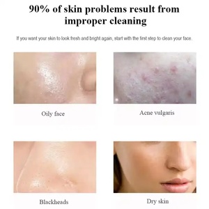 Limpiador Facial Orgánico con Aminoácidos OEM/ODM, Limpiador Facial Suave con Espuma Anti-Acné para Piel Seca - Product Image 5