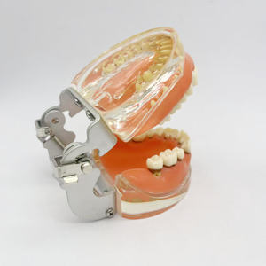 Parodontitis Model Medische Wetenschap Tandheelkundig Model Voor Opleiding In Scholen En Ziekenhuizen - Product Image 3