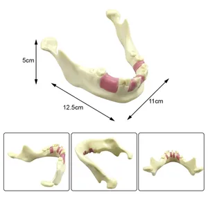 Modelo Dental de Práctica de Implantes, Modelo de Enseñanza de Dientes, Herramienta de Demostración para Entrenamiento Educativo, Modelo de Simulación de Hueso de Mandíbula Inferior - Product Image 2