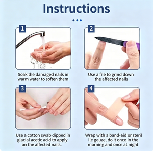 Solution antibactérienne à l'acide acétique, pour le traitement des infections fongiques des pieds, solution pour <span class=keywords><strong>bain</strong></span> <span class=keywords><strong>de</strong></span> pieds, exfoliation, démangeaisons, onychomycose - Product Image 3