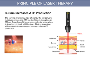 Lápiz de Acupuntura con Terapia Láser Fría de Clase II con Luz Roja e Infrarroja Cercana para la Regeneración Nerviosa y la Fibromialgia - Product Image 2