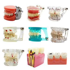 Modelo de Enseñanza Dental para la Comunicación Médico-Paciente, Restauración de Implantes Dentales <span class=keywords><strong>Removibles</strong></span>, Uso Clase I - Product Image 5