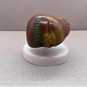 Modèle pédagogique biologique de pathologie hépatique avec base - Outil de démonstration anatomique pour l'enseignement de la hépatologie - Product Image 4