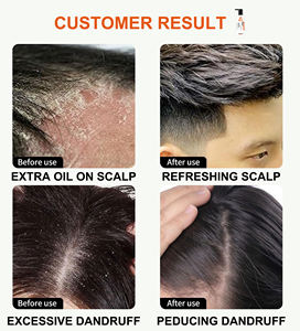 Biota Orientalis & Keratin ile kepek ve seboreik dermatit için Agerios kafa derisi tedavisi şampuan - Product Image 6