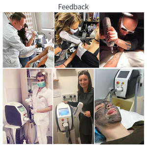 Macchina Laser per Rimozione Tatuaggi Nd Yag Q-Switched al Neodimio del 2023 - Product Image 6