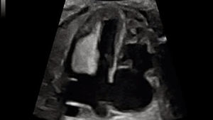 Ecógrafo Doppler Color 4D de Alta Calidad <span class=keywords><strong>Mindray</strong></span> <span class=keywords><strong>DC</strong></span>-70 <span class=keywords><strong>DC</strong></span>-80 <span class=keywords><strong>DC</strong></span>-<span class=keywords><strong>60</strong></span> con Carro y Pantalla de 21.5 Pulgadas para Uso Veterinario - Product Image 5