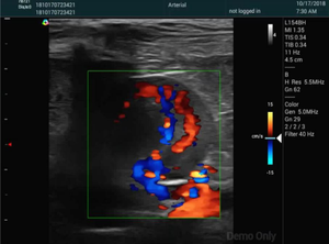 작은 동물을위한 전문 고속 스캔 수의학 컬러 도플러 초음파 선형 배열 선형 초음파 - Product Image 5