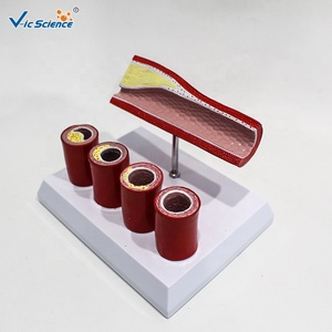 Modelo de Aterosclerosis de Arteria Coronaria con Trombosis que Simula Obstrucción Vascular para la Educación Clínica en Cardiología - Product Image 6