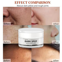Crème Visage Marque Blanche Anti-Taches de Rousseur, à la Vitamine C et Gluthathion, Éclaircissante et Blanchissante, pour l'Élimination des Taches Foncées