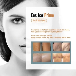 EOS Ice <span class=keywords><strong>Diode</strong></span> Máy tẩy lông bằng laser Ice tẩy lông 4 bước sóng văn phòng phẩm Máy tẩy lông bằng laser - Product Image 4