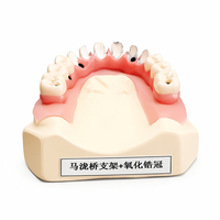 Modèle d'enseignement oral de qualité médicale de la marque Ecolab, modèle de pont dentaire, restauration d'implant, couronne en zircone, certifié ISO 9001 pour usage dentaire