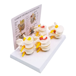 Tussenwervelschijf Degeneratie Osteoporose Model Lumbale Hernia Model Normale Plastic Lumbale Wervelkolom Model - Product Image 1