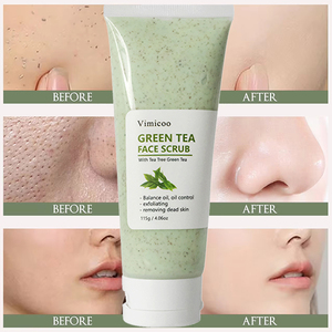 <span class=keywords><strong>Gommage</strong></span> Visage en Gros 4.1 oz Nettoyant Exfoliant à l'Extrait d'Arbre à Thé et Niacinamide pour Peaux Grasses Crème de Soin au Thé Vert - Product Image 1