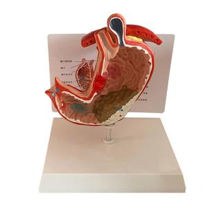 แบบจำลองการเปลี่ยนแปลงของกระเพาะอาหารในมนุษย์ สำหรับการสอนทางการแพทย์ด้านโรค<span class=keywords><strong>กระเพาะ</strong></span>อาหารและระบบทางเดินอาหาร - Product Image 4