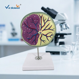 แบบจำลองทางกายวิภาคของรกและภาวะมดลูกอักเสบ ได้รับการรับรองมาตรฐาน CE ISO สำหรับการสอนทางสูติศาสตร์ในสถาบันการแพทย์ - Product Image 5