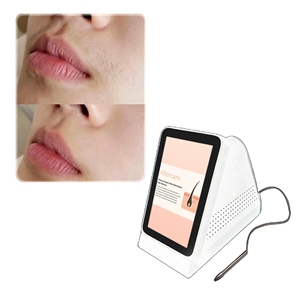 <span class=keywords><strong>Appareil</strong></span> médical clinique de précision à intervention minimale <span class=keywords><strong>pour</strong></span> l'épilation permanente des poils fins du visage en salon - Product Image 3