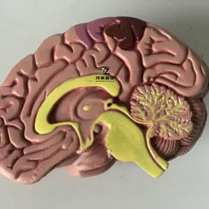Modelo de Enseñanza de Ciencias Médicas, Patología Humana, <span class=keywords><strong>Diabetes</strong></span>, Anatomía <span class=keywords><strong>en</strong></span> PVC para Escuelas de Medicina - Product Image 4