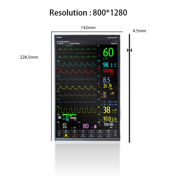 10.1" 800*1280 LCD Panel M101GWWC R5 Vertical Screen Patient Monitor Display 10.1 Inch LCD Modules