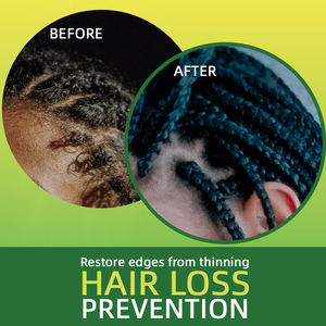 Luxfume Großhandel Olivenöl Minze lindern Juckreiz Haarwuchs Pflegendes Kopfhaut <span class=keywords><strong>massage</strong></span> öl - Product Image 5