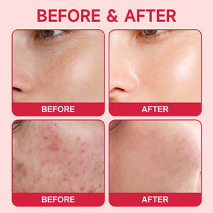 CHIC BEAUTE <span class=keywords><strong>Masque</strong></span> Gel de Nuit Repulpant, Hydratant et Éclaircissant à l'Acide Hyaluronique et au Lysate de Ferment de Bifida Rose, Marque Privée - Product Image 3