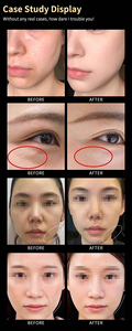 360Pro Desktop Facial Lifting & Body Shaping System: Professional Anti Aging, <b>Skin</b> Tightening, Collagen Regeneration for Beauty - Product Image 3