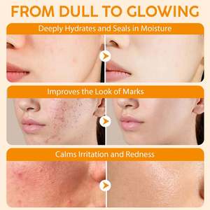 Baume pour la peau Elaimei 60g, hydratant, nourrissant, anti-âge, réduisant les rougeurs, les poches et les ridules, à l'huile de suif, de ricin et d'encens - Product Image 3