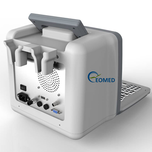 เครื่องตรวจอัลตร้าซาวด์หัวใจและท้อง, เครื่องตรวจอัลตร้าซาวด์ระบบหัวใจถาวร BW300มนุษย์ - Product Image 5