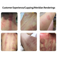 Machine professionnelle de détoxification corporelle par ventouses et grattage, appareil de massage de santé domestique Gua Sha