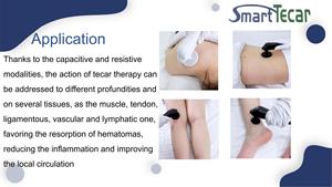 La physiothérapie 448k permet une meilleure flexibilité dans l'utilisation et un meilleur effet thérapeutique. - Product Image 5
