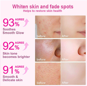 Suplementos Herbais Naturais YanniGlow OEM ODM, Chá Antioxidante para Clareamento e Branqueamento da Pele para Adultos - Product Image 4