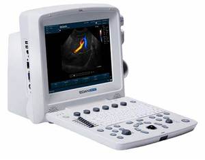 Échographe vétérinaire portable Edan U50 VET, échographe Doppler couleur pour la gestation animale et les hôpitaux vétérinaires - Product Image 5
