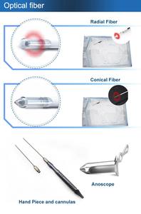 Máquina Cirúrgica Profissional para Remoção de Fístulas Anais e Hemorroidas 980nm e 1470nm, Máquina de Endolifting Proctológico, Preço - Product Image 4