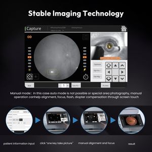 Aist Optics <b>Digital</b> Retinal <b>Camera</b> Kestrel 3100m Degree Wide Field Non-mydriatic Retinal Eye Fundus <b>Camera</b> for Ophthalmology - Product Image 5