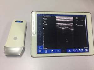 Mesin medis USG Linear Genggam kualitas tinggi, pemindai <span class=keywords><strong>Ultrasound</strong></span> portabel nirkabel IOS Android <span class=keywords><strong>Ultrasound</strong></span> Linear - Product Image 5