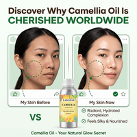 Approvisionnement direct usine : Huile de Camélia 100% Pure, Faible MOQ, Contenant Personnalisé, Huile Végétale Non Raffinée pour Fabricants de Cosmétiques