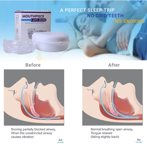 再利用可能な歯科用いびき防止マウスガード、EVA素材を使用した環境に優しいデザインで、睡眠の改善と歯ぎしりの予防に - Product Image 5