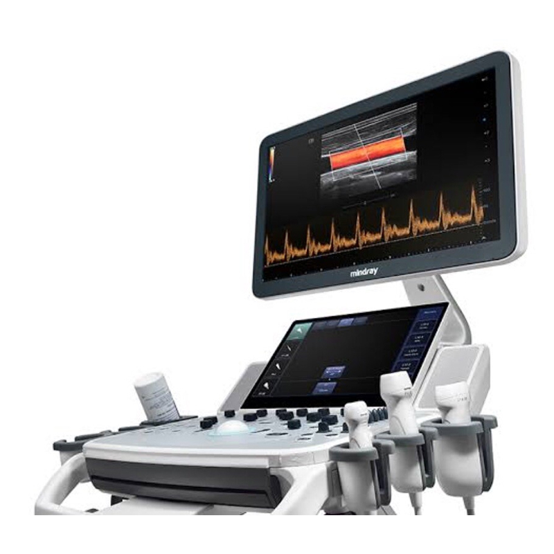 GE Logiq E Second Hand Refurbished