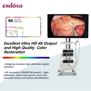 UHD 4K nội soi nội soi <span class=keywords><strong>Video</strong></span> nội soi Máy ảnh y tế nội soi Hệ thống <span class=keywords><strong>camera</strong></span> - Product Image 6