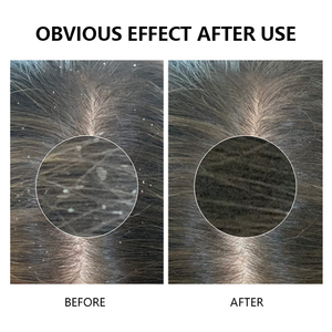 Tonico per il Cuoio Capelluto con Etichetta Privata, Attiva le Radici dei Capelli, Riduce la Caduta per Capelli Fini e Diradati, Stimolante Naturale alla Caffeina per Donne - Product Image 6