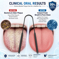 Kit de Nettoyage Buccal Personnalisable Noir – Ensemble de Trois Outils en Acier Inoxydable avec Étui Métallique, Faible MOQ