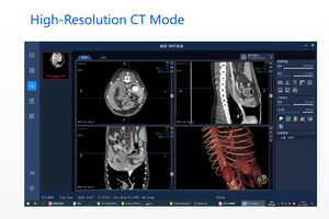 Intègre trois fonctions principales : <span class=keywords><strong>scanner</strong></span> rapide RAD FLO CT pour chiens/chats en 10 secondes, portique en C, prend en charge la RCP/DSA, raisonnable - Product Image 4