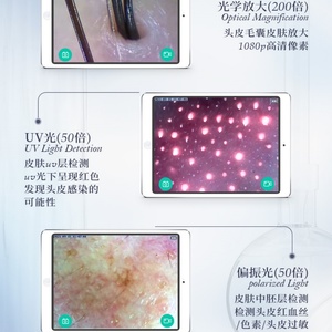 Analizador Portátil de Folículos Capilares y Piel, Nuevo Escáner de Piel, Analizador de Cabello y Piel, Máquina de Belleza, Detector HD de Cabello y Cuero Cabelludo - Product Image 6