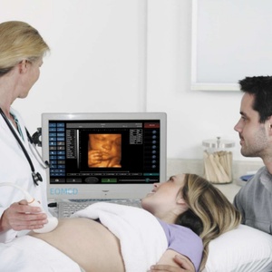 Échographe à écran tactile haute performance, écran LED 18,5 pouces, design élégant, appareil d'échographie noir et blanc vétérinaire BW08 - Product Image 6