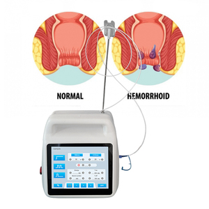 <strong>Hemorrhoid</strong> <strong>Removal</strong> Machine 980nm 1470nm 50W Internal <strong>Hemorrhoids</strong> Piles <strong>External</strong> Anal Fissure - Product Image 2