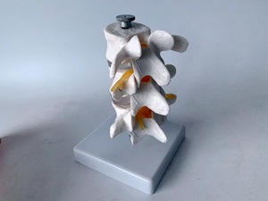 Model herniasi Lumbar manusia kolom tulang belakang vertebra dapat dilepas untuk chiropractor 3 Model vertebra - Product Image 3