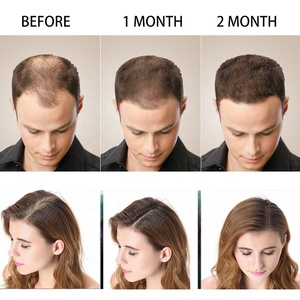 Champú Disaar para el Crecimiento del Cabello con Plantas Naturales, Nutritivo y Útil - Product Image 2