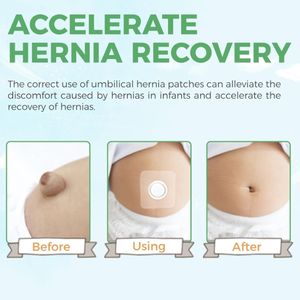 แถบรัดสะดือสะดือใสกันน้ำสำหรับทารกแรกเกิดผ้าปะติดยืดหยุ่นได้แถบรัดหน้าท้องสำหรับป้องกันแผล - Product Image 3